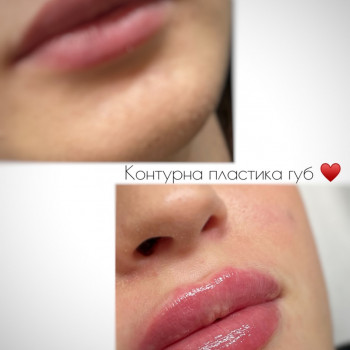 Марта Гнатів, Львів Фото - 5