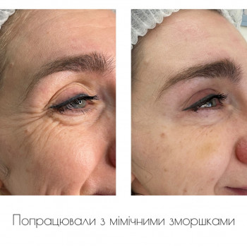 Марта Гнатів, Львів Фото - 6