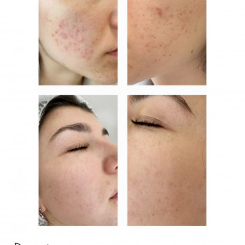 Марта Гнатів, Львів Фото - 7