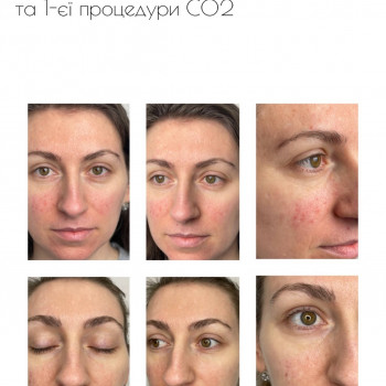 Домашній догляд важливий 🤍