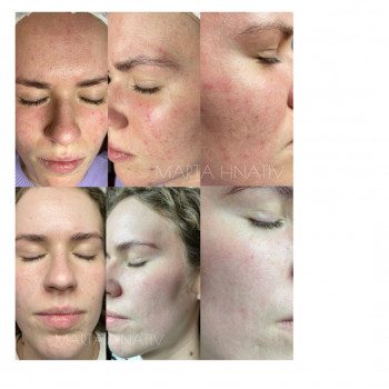 Марта Гнатів, Львів Фото - 9