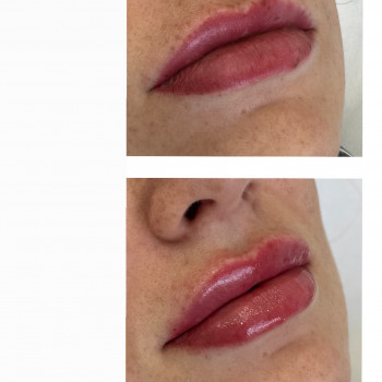 Марта Гнатів, Львів Фото - 10