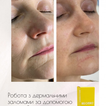 Марта Гнатів, Львів Фото - 11