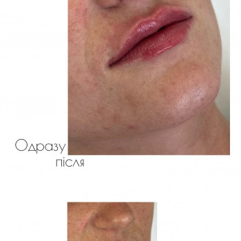 Марта Гнатів, Львів Фото - 12