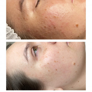 Марта Гнатів, Львів Фото - 13