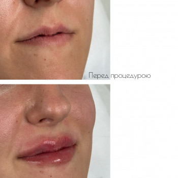 Марта Гнатів, Львів Фото - 14