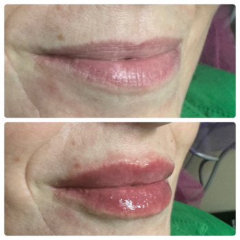 Лариса Петрівна, Луцьк Фото - 28