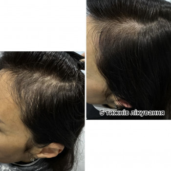 OmeoWeek+
                    Салон красоты Центр Красоты и Здоровья Волос Киев