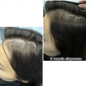 OmeoWeek+
                    Салон красоты Центр Красоты и Здоровья Волос Киев