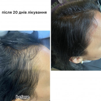 OmeoWeek+
                    Салон красоты Центр Красоты и Здоровья Волос Киев