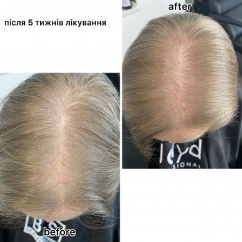 OmeoWeek+
                    Салон красоты Центр Красоты и Здоровья Волос Киев