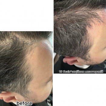 OmeoWeek+
                    Салон красоты Центр Красоты и Здоровья Волос Киев