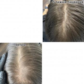 OmeoWeek+
                    Салон красоты Центр Красоты и Здоровья Волос Киев