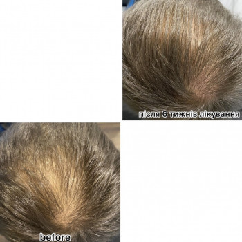 OmeoWeek+
                    Салон красоты Центр Красоты и Здоровья Волос Киев