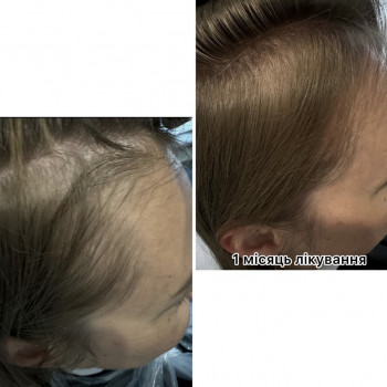 OmeoWeek+
                    Салон красоты Центр Красоты и Здоровья Волос Киев