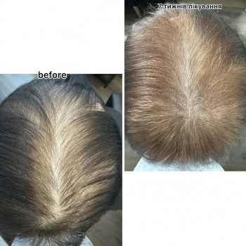 OmeoWeek+
                    Салон красоты Центр Красоты и Здоровья Волос Киев