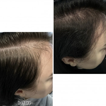 OmeoWeek+
                    Салон красоты Центр Красоты и Здоровья Волос Киев