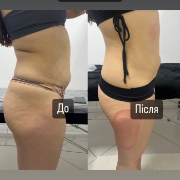 Фото з портфоліо косметолога Ірина Хорошенко (Луцьк)