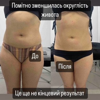 Фото з портфоліо косметолога Ірина Хорошенко (Луцьк)