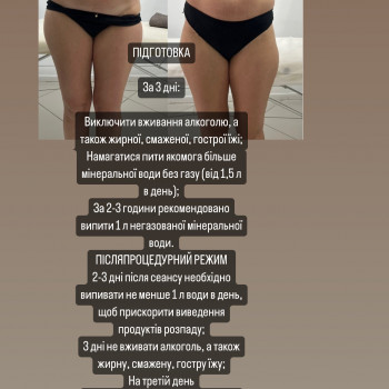 Фото з портфоліо косметолога Ірина Хорошенко (Луцьк)