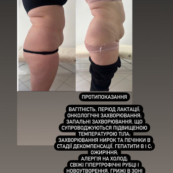 Фото з портфоліо косметолога Ірина Хорошенко (Луцьк)