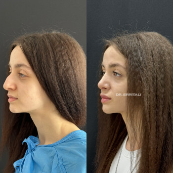 Абдель Эрритали, Харків Фото - 6