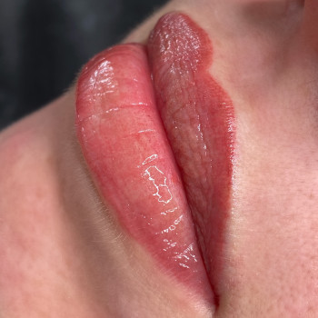 Перманент губ
                    Косметолог-инъекционист Катерина Киев