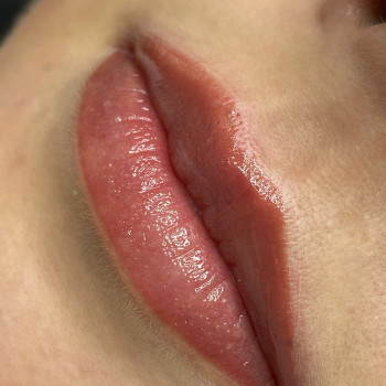 Перманент губ
                    Косметолог-инъекционист Катерина Киев