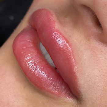 Перманент губ
                    Косметолог-инъекционист Катерина Киев