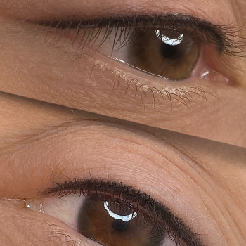 Перманентний макіяж повік. 
Міжвійка.
Одразу після процедури