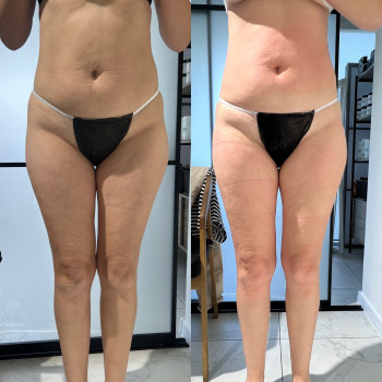 Tonus, Хмельницкий Фото - 6