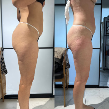 Tonus, Хмельницкий Фото - 9