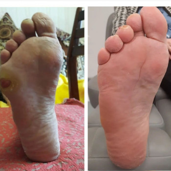 Фото з портфоліо фахівця Руслана Гончарова (подолог, Миколаїв)