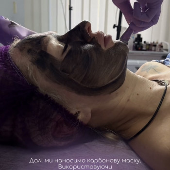 Карбоновий пілінг
                    Майстер перманентного макіяжу Анна Полтава