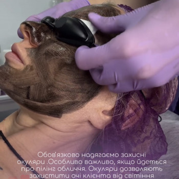 Карбоновий пілінг
                    Майстер перманентного макіяжу Анна Полтава