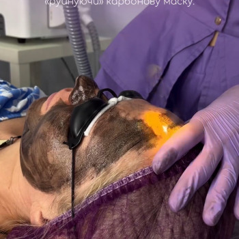 Карбоновий пілінг
                    Майстер перманентного макіяжу Анна Полтава