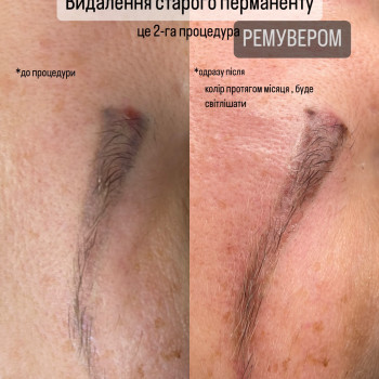  #видалення ремувером неякісного перманенту