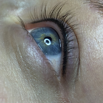 Межресничка