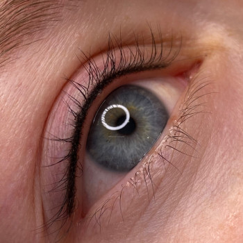 Межресничка