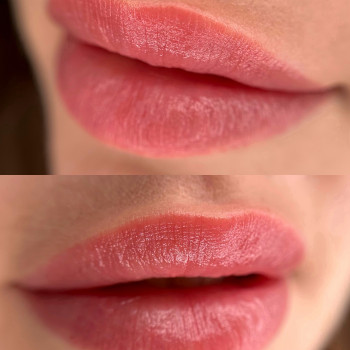 Загоєні губки (запит - натюрель)