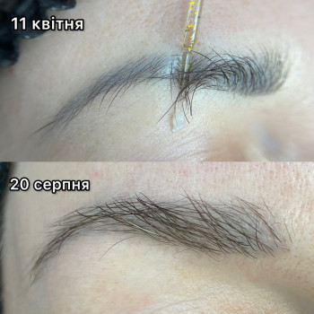 Результат 2 видалень