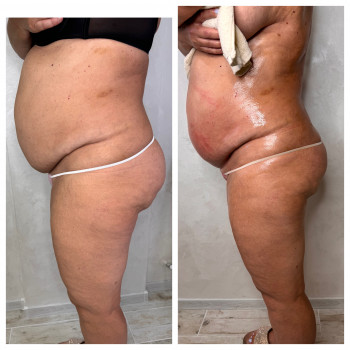    поселоккотовского   поселоккотовского  поселоккотовского   поселоккотовского  поселоккотовского...