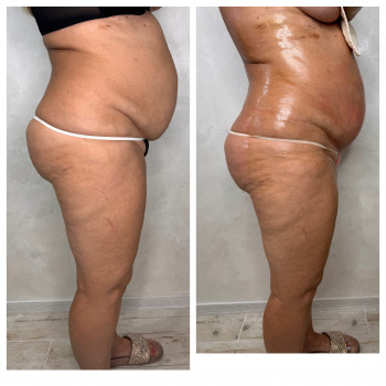    поселоккотовского   поселоккотовского  поселоккотовского   поселоккотовского  поселоккотовского...