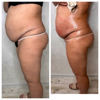    поселоккотовского   поселоккотовского  поселоккотовского   поселоккотовского  поселоккотовского...