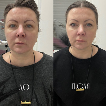 Коктейль Монако
                    Косметолог Виктория Київ