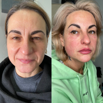 Коктейль Монако
                    Косметолог Виктория Київ