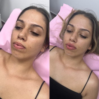 Юлія Кондратюк, Ровно Фото - 1