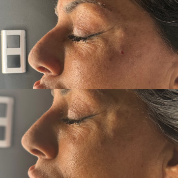 Юлія Кондратюк, Ровно Фото - 2