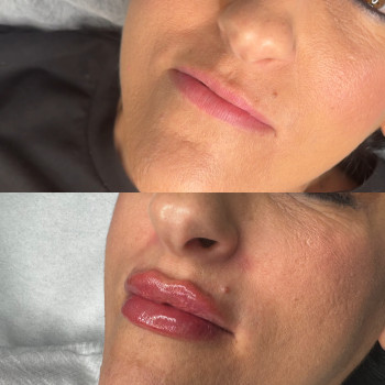 Юлія Кондратюк, Ровно Фото - 3