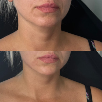 Юлія Кондратюк, Ровно Фото - 4